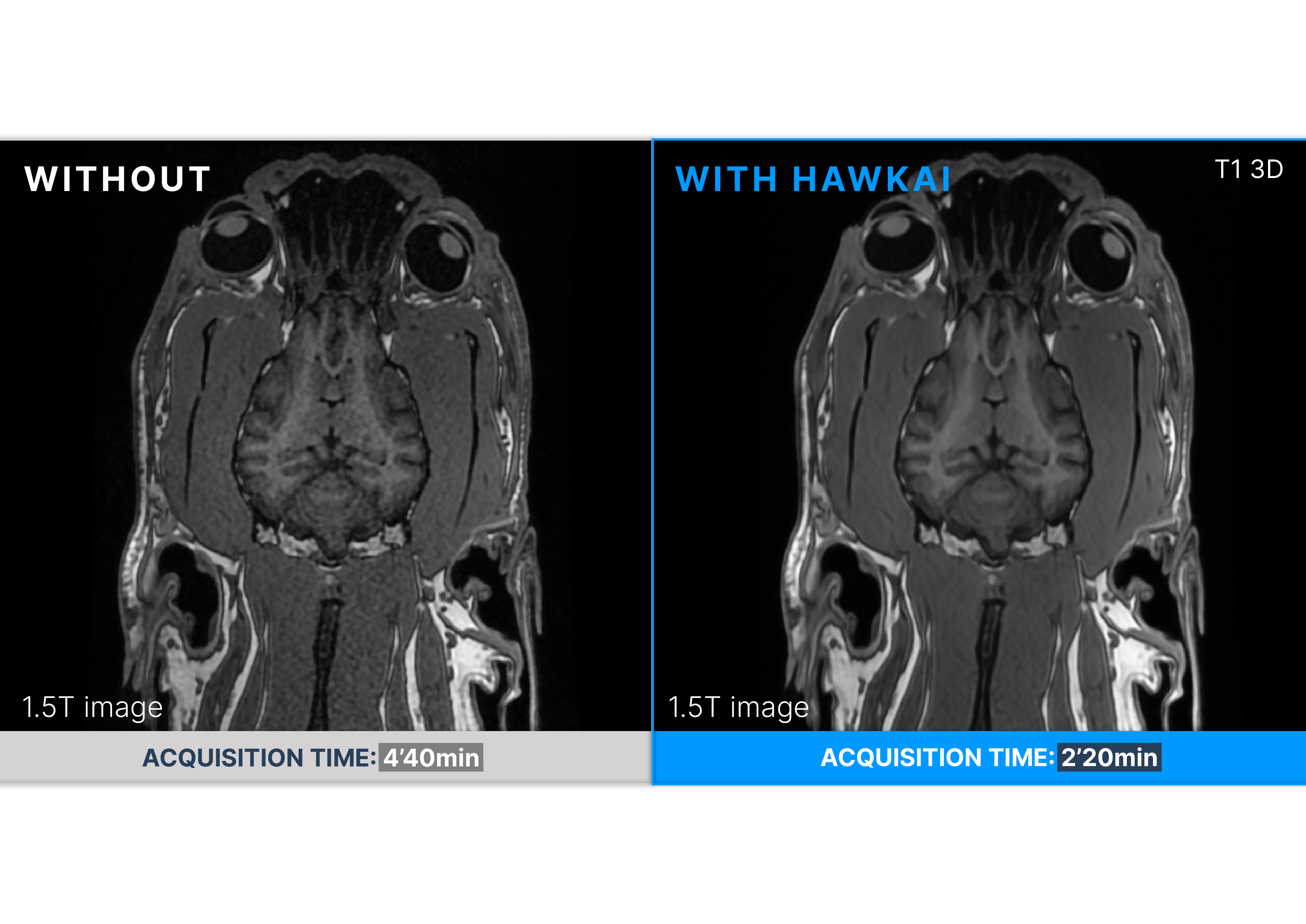 Before / After HawkAI