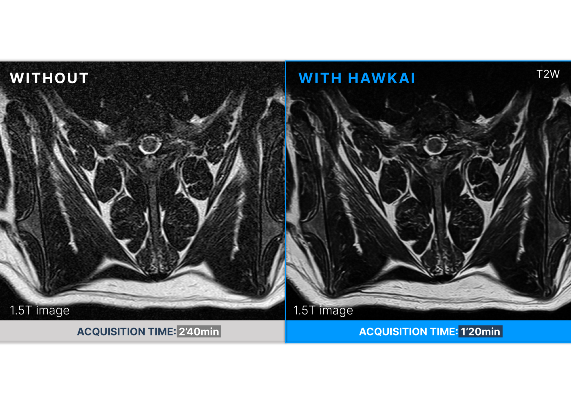 Before / After HawkAI