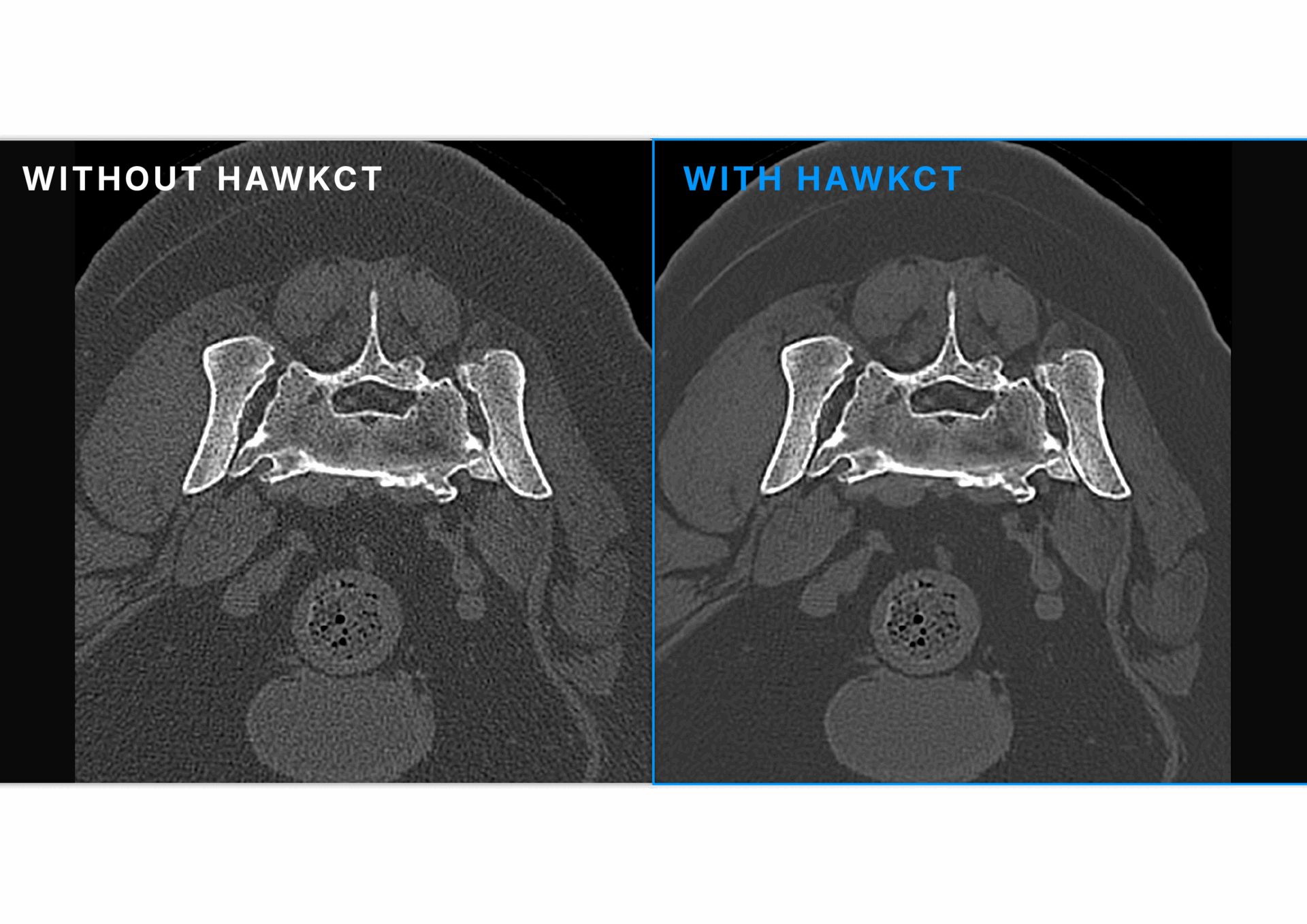 SHARPER HAWKCT ENG