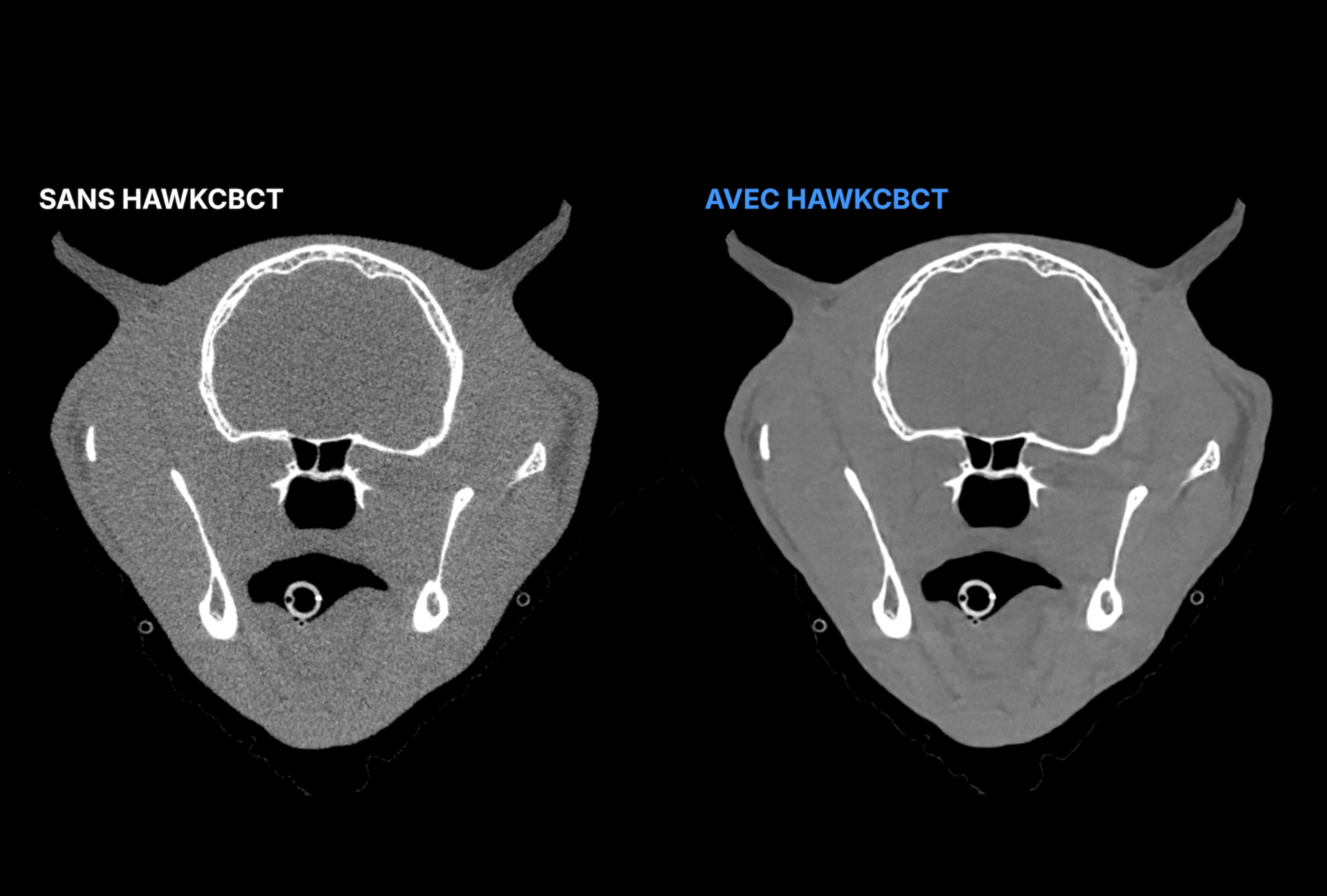 HAWKCBCT BANERFR