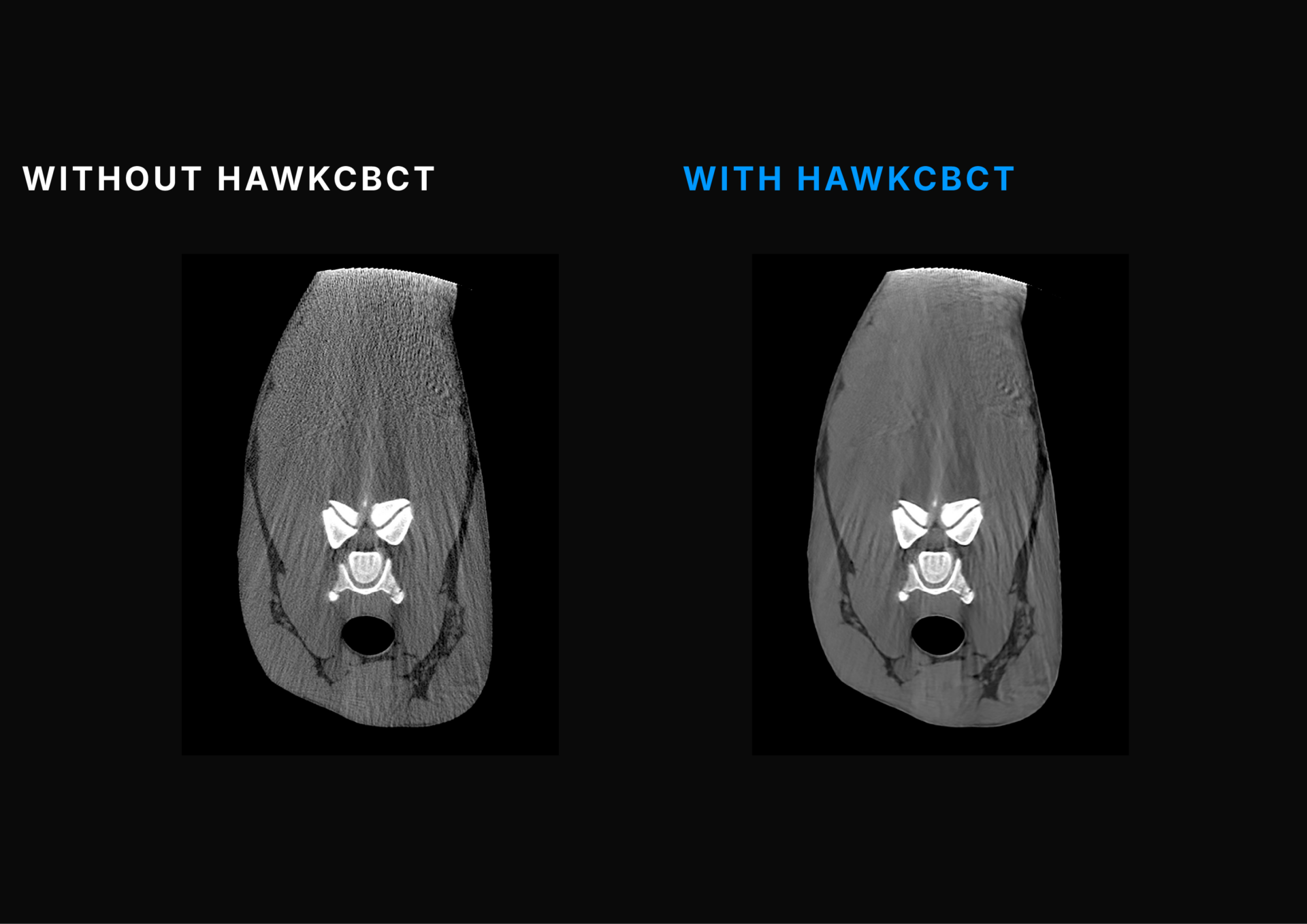 TEMPLATE PHOTO HAWKCBCT#2