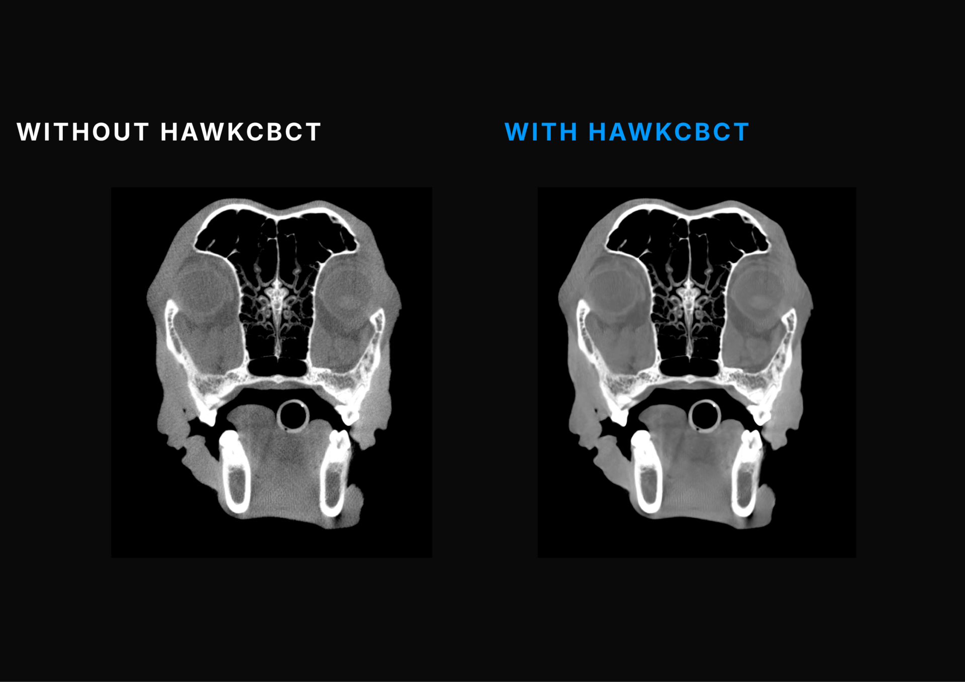 TEMPLATE PHOTO HAWKCBCT#3