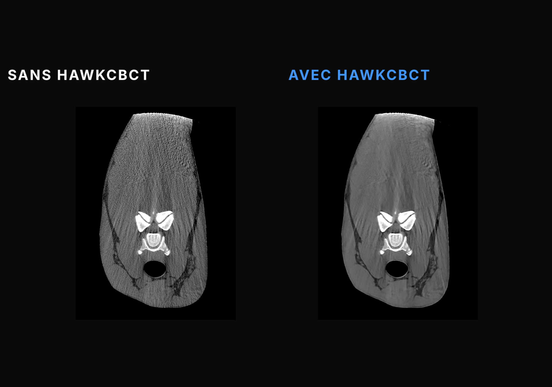 TEMPLATE PHOTO HAWKCBCTFR#2