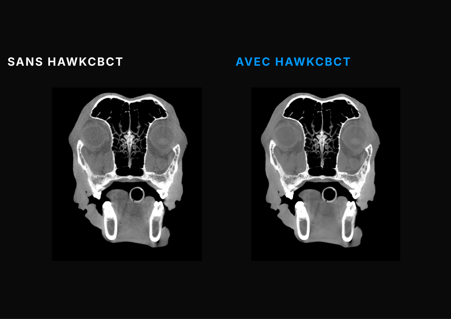 TEMPLATE PHOTO HAWKCBCTFR#3